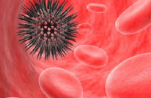 Bu belirtiler varsa hızlı yaypılabilir! İşte Lenfoma kanserinin belirtileri