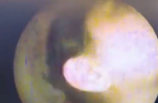 İzmir'de eşinin kulağını öpen şahıs kulak zarını patlattı! Doktor uyardı: Vakumlayarak öpmeyin