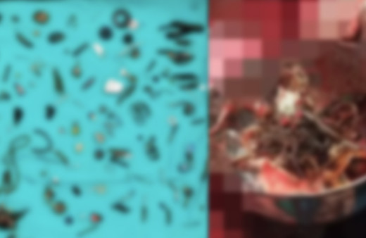 Midesinde çıkanlarla sergi açılır! Öyle şeyler çıktı ki Doktorlar bile şaştı kaldı