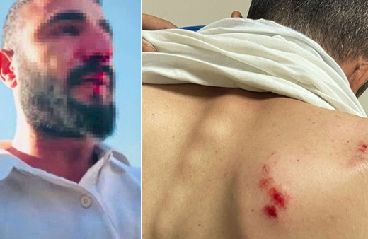 Siirt'te kaçak elektrik denetimi yapan görevlilere saldırı!