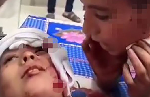 Filistinli çocuğun, yaralı kardeşinin kulağına söyledikleri yürek yaktı! Şehadet getirmeyi öğretti