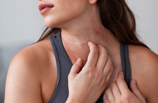 Uyuz hastalığından kurtulmak mümkün mü?