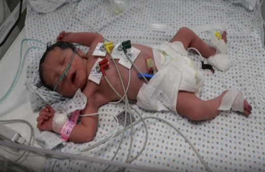 Gazze'de İsrail saldırısında ölen annenin karnından çıkarıldı ölen annenin eşine son sözleri ortaya çıktı