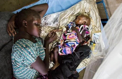 Afrika'nın 21 ülkesinde çocuk felci vakası görülüyor