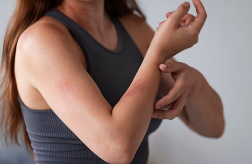 Cildiniz en küçük bir çarpmada bile morarıyorsa dikkat!