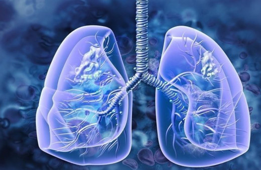 Akciğer kanserinin en yaygın belirtisi açıklandı