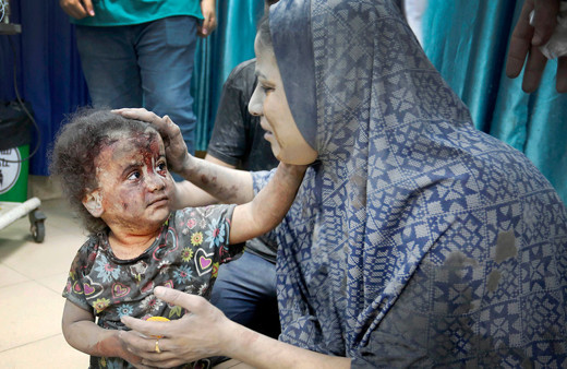 İsrail Çocuk Hastanesi'ni bombaladı! BM acı rakamları açıkladı! Ölenlerin yüzde 67'si çocuk ve kadın...