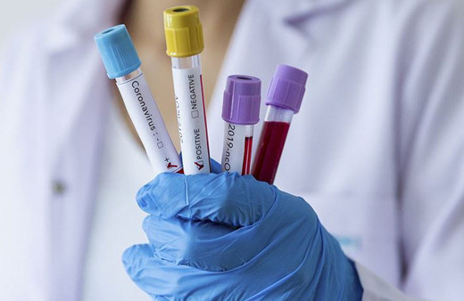 Korkutan haber! Kovid-19 kaynaklı ölüm oranında artış yaşanıyor