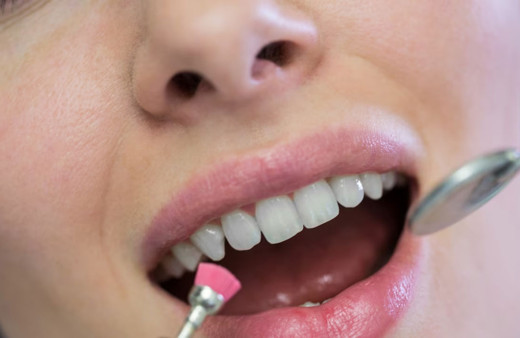 Dişinizi beyazlatmak isterken diş kaybına sebep olabilirsiniz!
