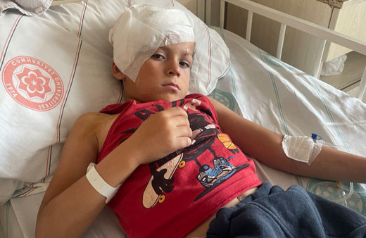 Köpek saldırısında yaralanan çocuk 4 ameliyat geçirdi!