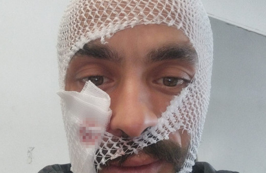 Çorum'da ineğinin boynuz darbeleri ile yaralanan genç gülümsetti