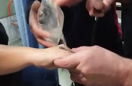 Parmağına sıkışan yüzüğü itfaiye ekipleri çıkardı