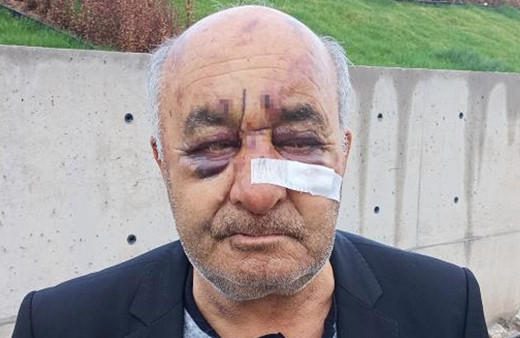 Öldüresiye dövülen taksici içler acısı halde! Korku dolu o anları böyle anlattı