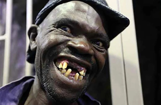 4 kez "dünyanın en çirkin insanı" seçilen Maison Sere hayatını kaybetti