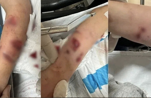 Bu kez de Rize! Başıboş köpekler oynayan çocuğa saldırdı