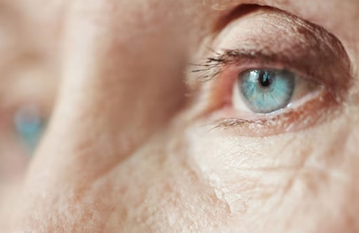 Katarakt tedavi edilmediğinde görme kaybına neden olabiliyor!