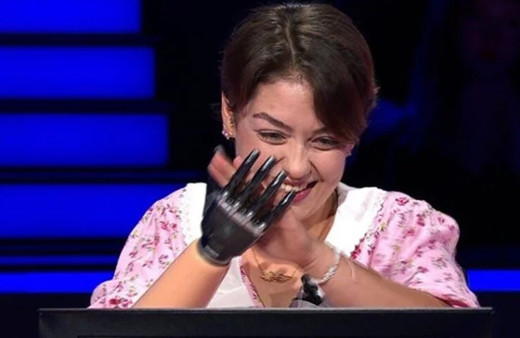 Hikayesiyle Türkiye'nin en çok konuşulanı olan Rabia, deneme kol protezini aldı