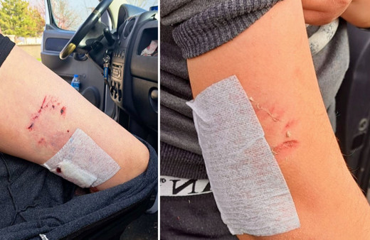 Kütahya’da sahipsiz köpekler öğrenciye saldırdı!