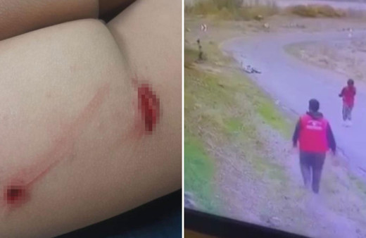 Ankara'da bisiklet süren çocuğa başıboş köpek saldırdı!