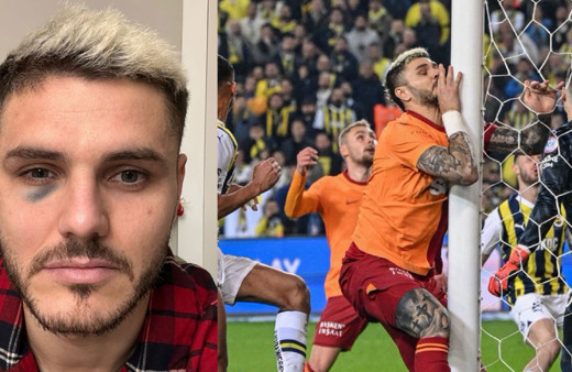 Derbi sonrası Fenerbahçe ile Galasataray Icardi için kapıştı! Dirsek mi morarttı direğe çarptığı için mi morardı