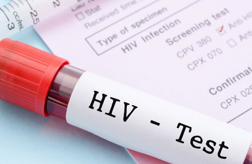 Erkek sünneti, HIV enfeksiyonuna karşı koruyor!