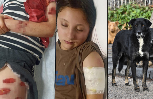 Şanlıurfa'da sokak köpeği saldırısı! Kız çocuğunu resmen parçalamışlar