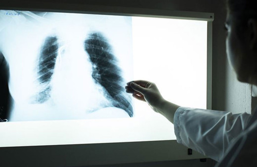 KOAH nedeniyle ölen kadın sayısı erkeklerden daha fazla olmaya başladı!