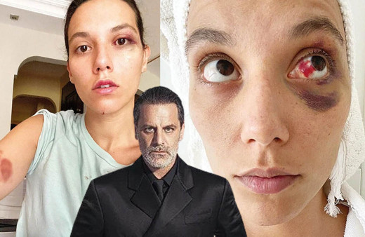 Ozan Güven'in eski sevgilisine darp davasında Adli Tıp Kurumu raporu hazırlandı