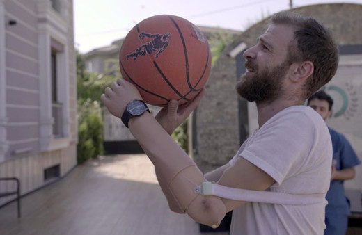 Sokakta yürürken bombanın hedefi oldu, kaybettiği organlarına protezle kavuştu!