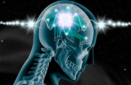 İlk kez bir insana beyin çipi yerleştirildi Elon Musk ilk sonuçları açıkladı