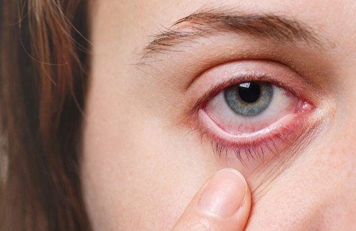 El Nino göz hastalıklarında artışa neden oluyor!