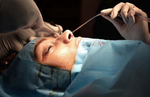 İzmir'de güzellik merkezinde yaşandı: Dolgu yaptırdı, burnunu kaybetti!