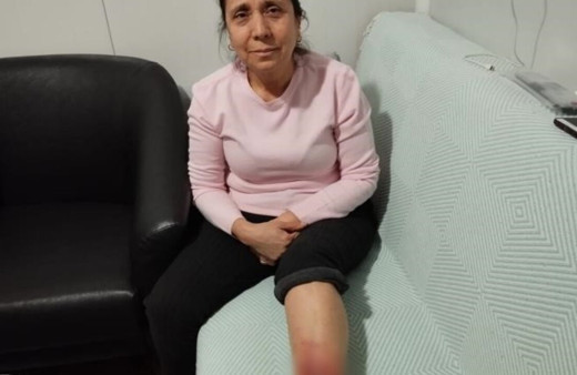 Köpek saldırısına uğrayan kadının bacağında yarık oluştu