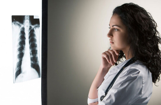 Kadınlarda akciğer kanseri vakalarında artış yaşanıyor