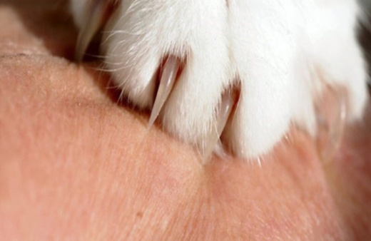 Kedi besleyenler dikkat! 'Kedi tırmığı' hastalığı her yıl giderek artıyor