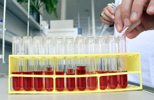 Hemofilide yeni tedavi yöntemi hastanın yaşam kalitesini artırıyor