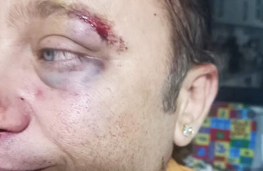 Onur Akay saldırıya uğradı! Kadir Doğulu detayı dikkat çekti