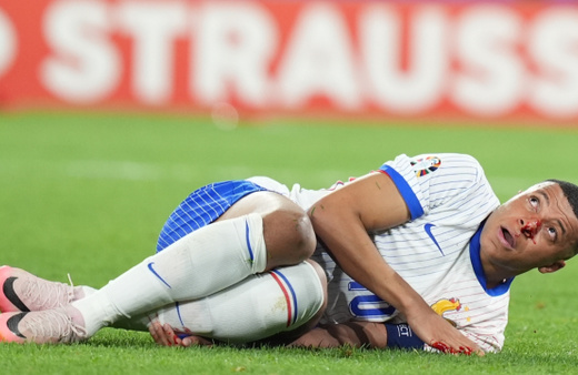Fransa'nın yıldızı Kylian Mbappe, kanlar içinde yerde kaldı