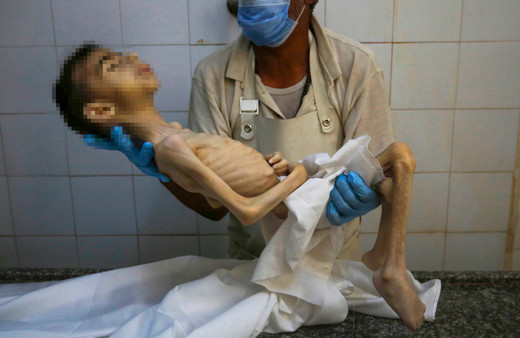 İnsanlıktan utandıran görüntüler! Gazzeli Hikmet, yetersiz beslenme nedeniyle öldü