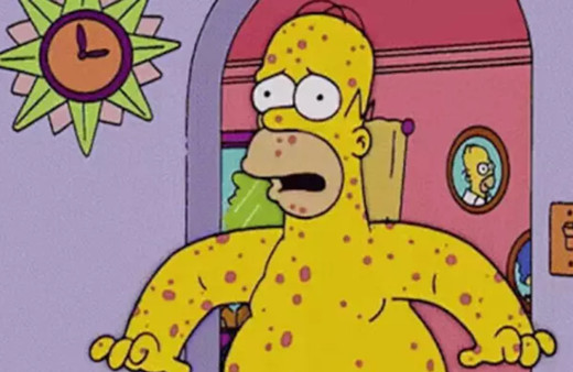 Maymun Çiçeği virüsünde Simpsonlar detayı! Yine bildler