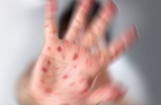 11 öğrencide görüldü! Solunum yolu ve temasla bulaşıyor