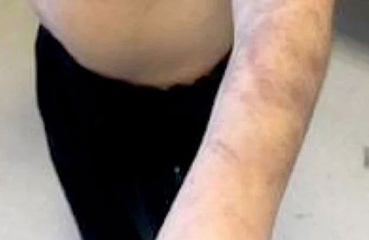 Beylikdüzü'nde özel bakım merkezinde otizmli çocuğa şiddet iddiası