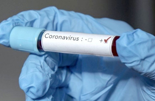 Çinli araştırmacılar insanlara bulaşma riski taşıyan yeni tip koronovirüs tespit etti