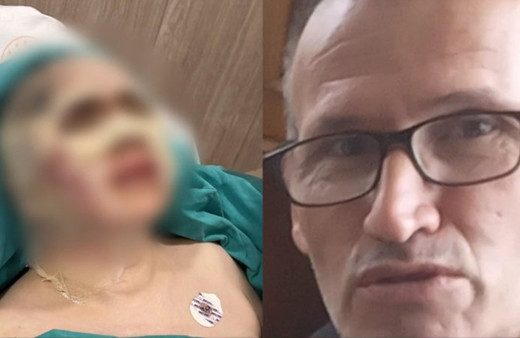 Karşılıksız aşk vahşeti! 60 yaşındaki adam 44 yaşındaki kadına kezzap atıp gözlerini kör etti