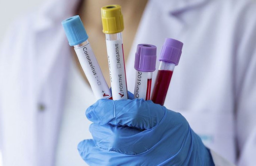 Acil durum 2023'te kalktı! Kovid-19 ölümleri sürüyor