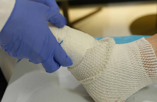 65 yaşındaki diyabet hastasının ayağı kesilmekten kurtuldu