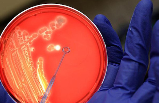 Ülkede bir hastalık tekrar hortladı! Yıllar sonra ilk ölüm