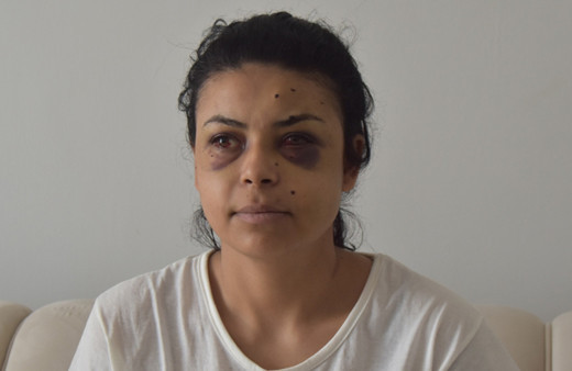 Pencereden düğünü izlerken dehşeti yaşadı! Tüfekten çıkan saçmalar genç kadına isabet etti