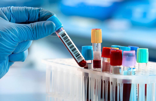 Akılcı Test İstem Listesi! Doktorlar sadece bu tahlilleri isteyebilecek