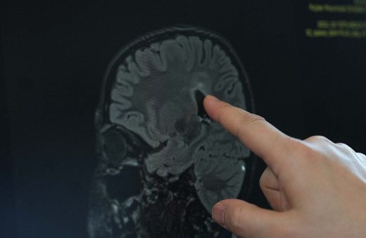 Yürüme güçlüğü olan çocuklara umut